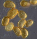 Des spores de fougère.jpg