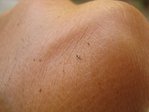 insecte haie.JPG